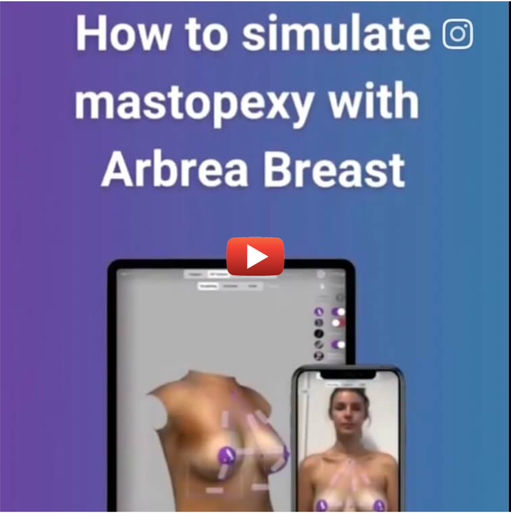 Arbrea-Breast-video-3.1