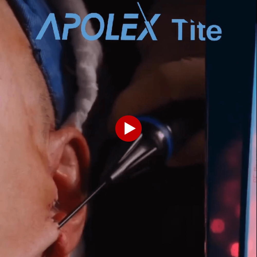 APOLEX TITE -4